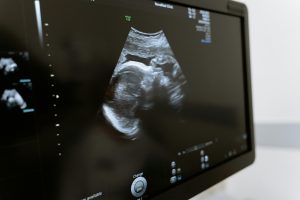 Lire la suite à propos de l’article Les accouchements vont reprendre à la maternité de Sarlat